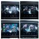 Billede af Renault Zoe 52 kWh GO 108HK 5d Aut.