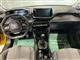 Billede af Peugeot 208 1,2 PureTech Allure Pack 100HK 5d 6g