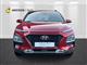 Billede af Hyundai Kona 1,0 T-GDI Trend 120HK 5d 6g