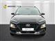 Billede af Hyundai Kona 1,6 T-GDI Trend DCT 177HK 5d 7g Aut.