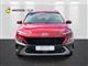 Billede af Hyundai Kona 1,0 T-GDI Advanced 120HK 5d 6g