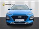 Billede af Hyundai Kona 1,0 T-GDI Limited Edition 120HK 5d 6g