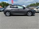 Billede af Peugeot 208 1,5 BlueHDi Allure+ 102HK 5d 6g