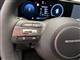 Billede af Hyundai KONA Electric 65,4 kWh Ultimate Long Range 217HK 5d Aut.