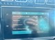 Billede af Citroën C3 Aircross 1,5 Blue HDi Origins 100HK 5d