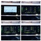 Billede af Peugeot 2008 1,2 PureTech GT EAT8 130HK 5d 8g Aut.